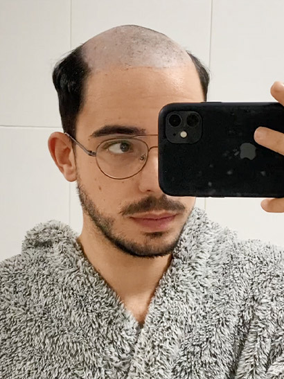 Photos avant et après